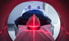 NHS ‘nowhere near ready’ to deliver new Alzheimer’s drug, doctors say