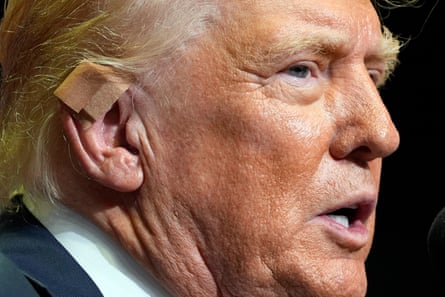 Close-up of older white man with orangey skin and hair with tip of right ear covered in beige bandage.