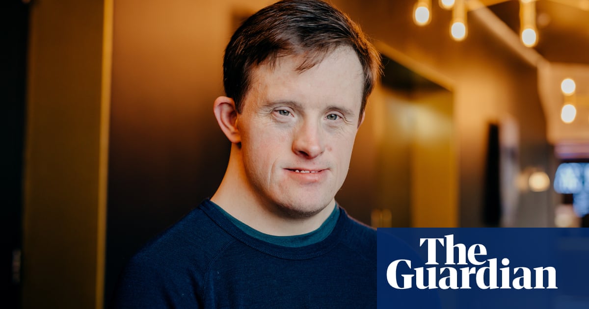 ‘It’s time for us to live our lives to the full’: Line of Duty’s Tommy Jessop on changing the world for people with Down’s syndrome