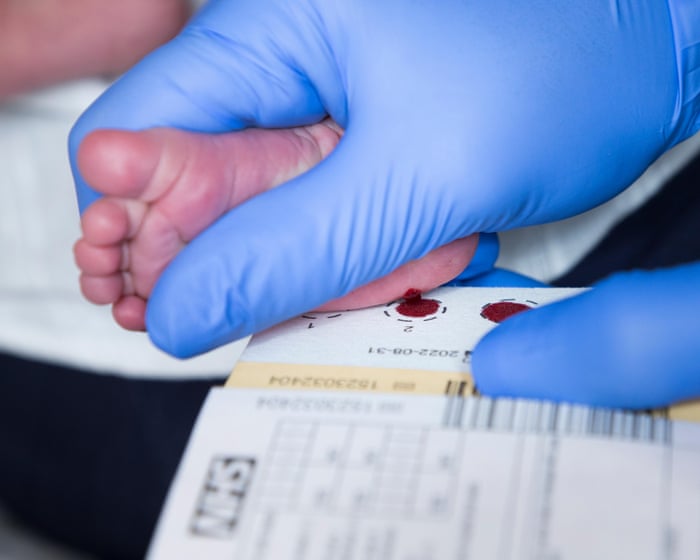 Scotland becomes first part of UK to screen newborns for spinal muscular atrophy