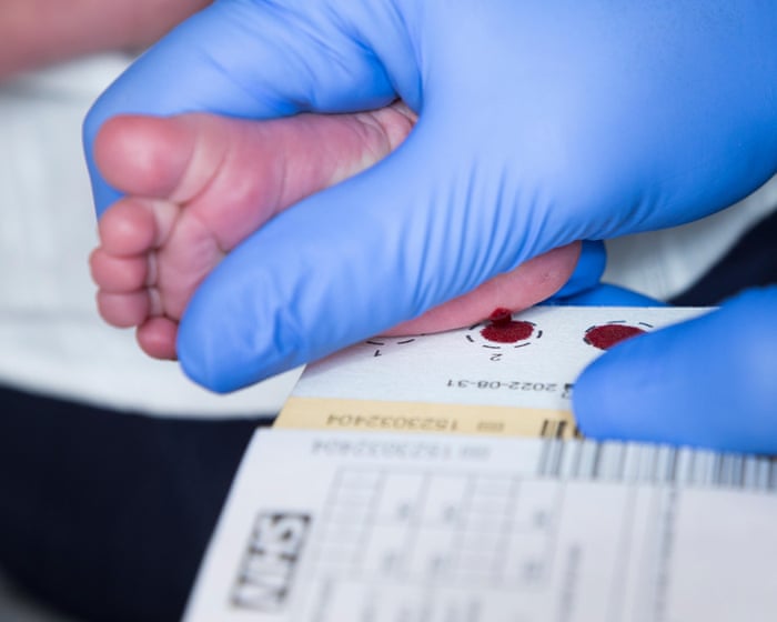 All newborns in England to be screened for spinal muscular atrophy from 2027