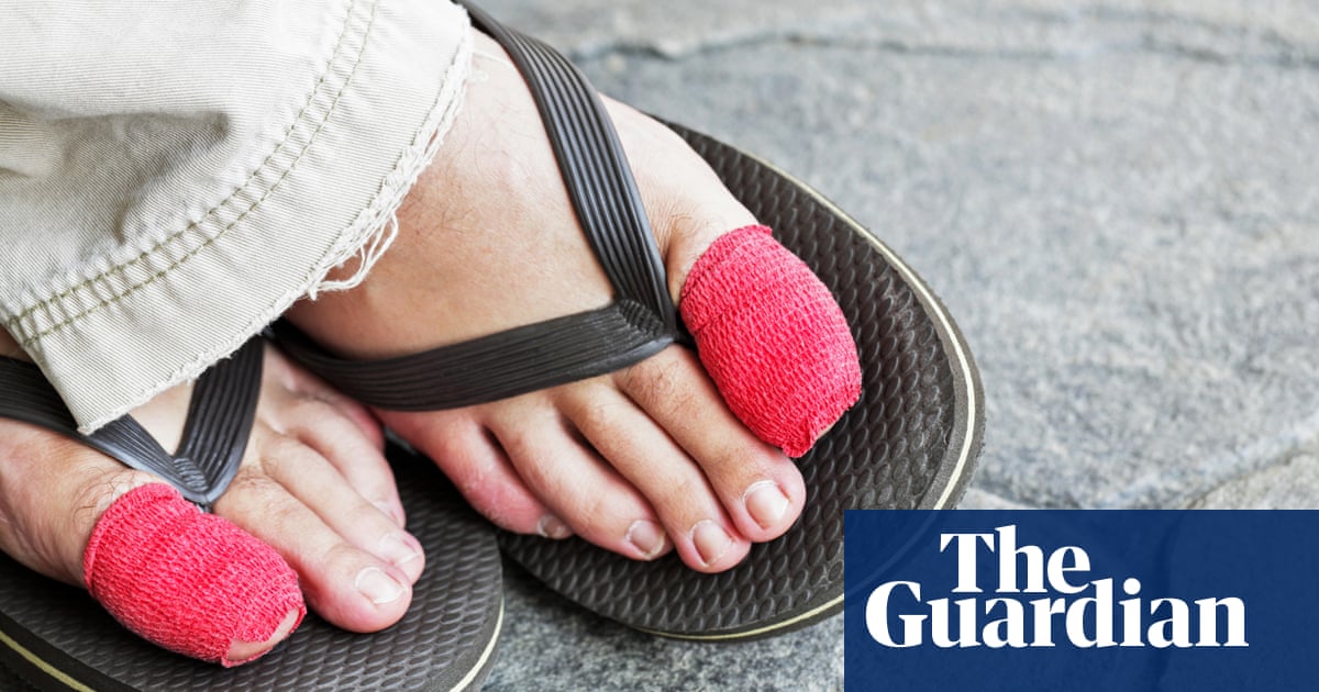 What are ingrown toenails, and how can I avoid them?