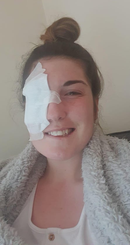 Amy Goddard in 2021 after being diagnosed with Bell’s palsy