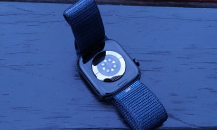 The metal back of the Apple Watch Series 10.