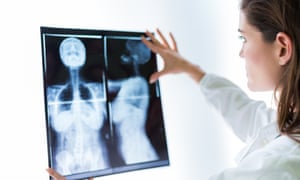 A leading cancer researcher said the experiment was proof that we are on the ‘cusp of a major revolution’ in being able to target cancer with immunotherapy.
