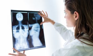 Doctor examining an X-ray