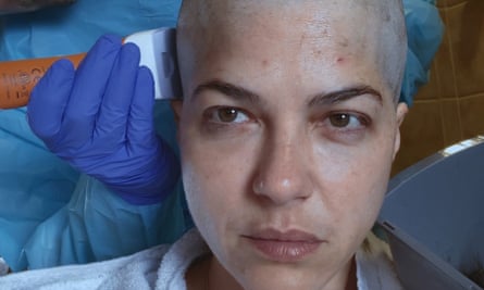 Close-up of Selma's face, bald, in a still from her documentary.