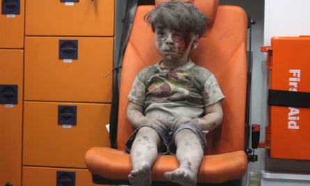 The photo of five-year-old Syrian boy Omran Daqneesh that caused an international outcry.