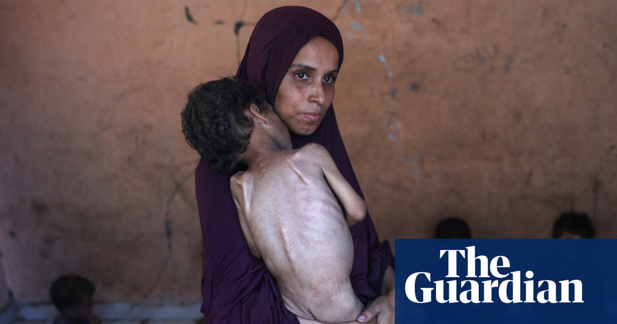 Šéf WHO: Gaza čelí hromadnému hladomoru spôsobenému človekom, humanitárne organizácie bijú na poplach