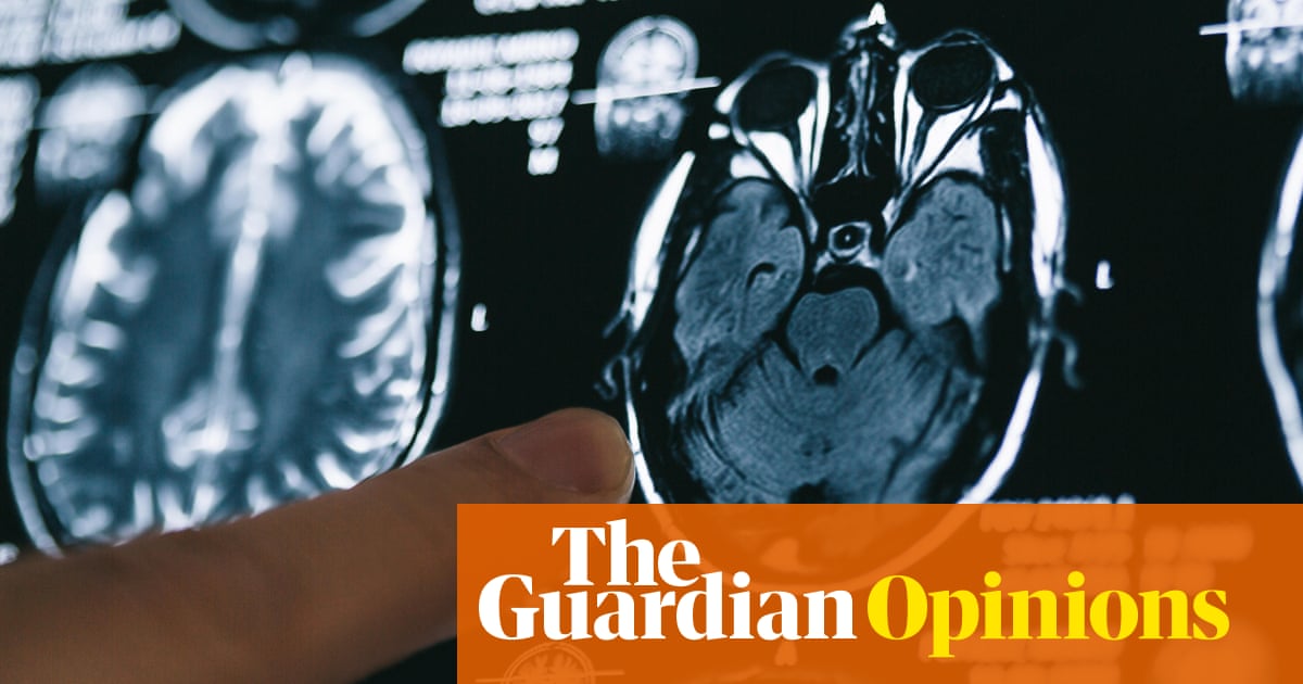 What do we know about Covid’s impact on the brain? | Eric Topol