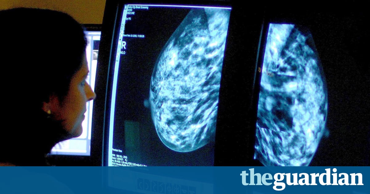 Breast cancer drug rejected for NHS use on cost-benefit grounds