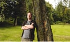 Experience: my dad set me on fire
