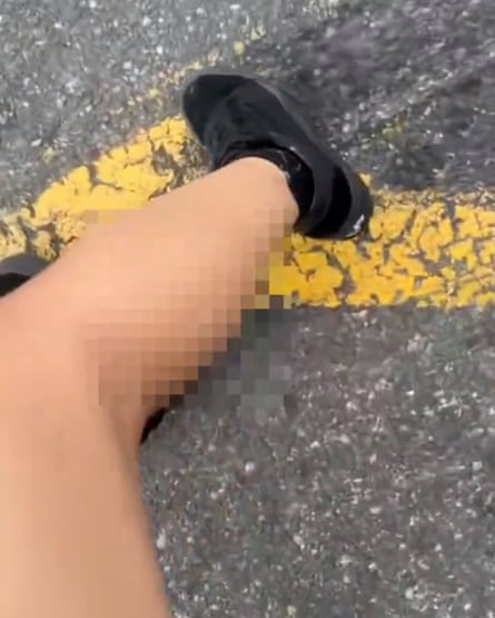 Censored image of semen on a woman’s calf while she’s in a parking lot
