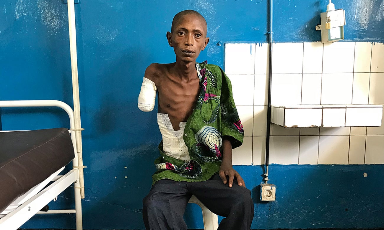 A 22-old rebel soldier, wounded and now dying, in a hospital in Masisi, DRC. 