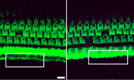 Treatment with a genome editing agent can preserve sound-detecting bristles in the inner ear of mice with genetic deafness (white box, left). Without the treatment, these bristles disappear (white box, right).