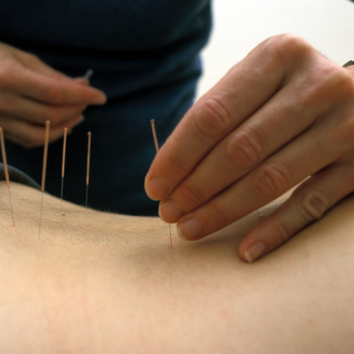 Best Acupuncture London