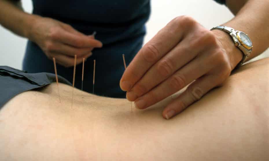 Previous guidelines recommended that healthcare providers “consider offering a course of acupuncture needling comprising up to a maximum of 10 sessions over a period of up to 12 weeks.”