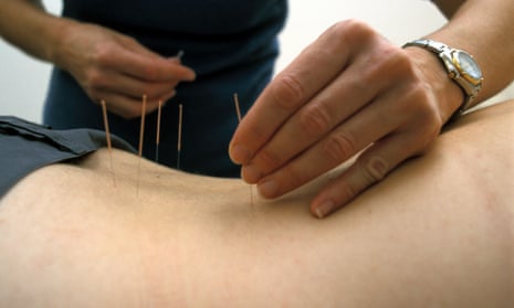 An acupuncturist works on a patient