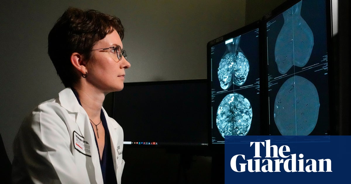 Groundbreaking genomic test could spare millions of breast cancer patients chemotherapy