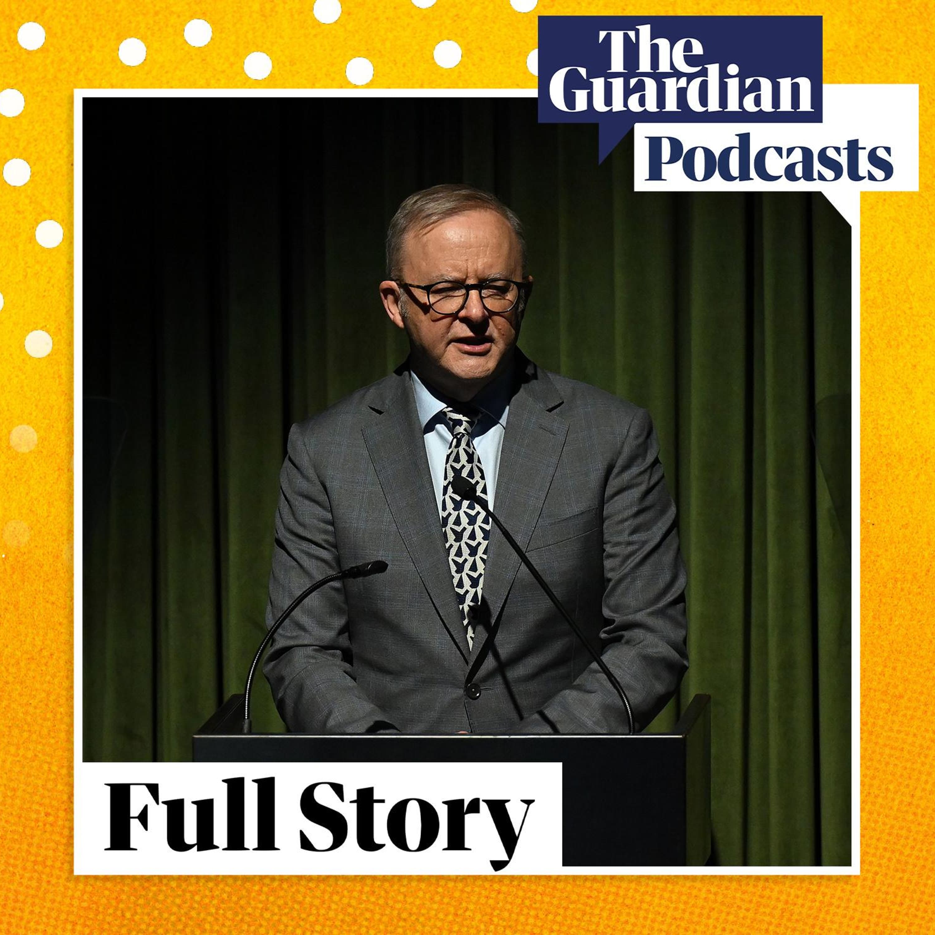 Will Albanese’s caution become his weakness? Will Albanese’s caution become his weakness?