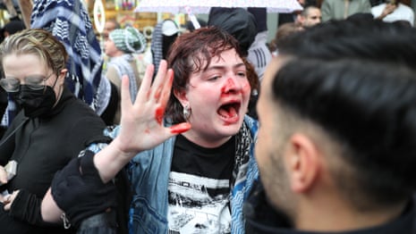 Berlin police investigate after officer punches Irish activist at protest | Protest | The Guardian