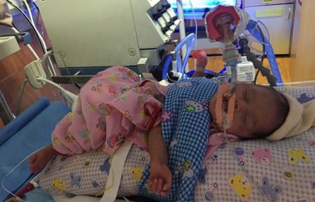 Baby born with malformation