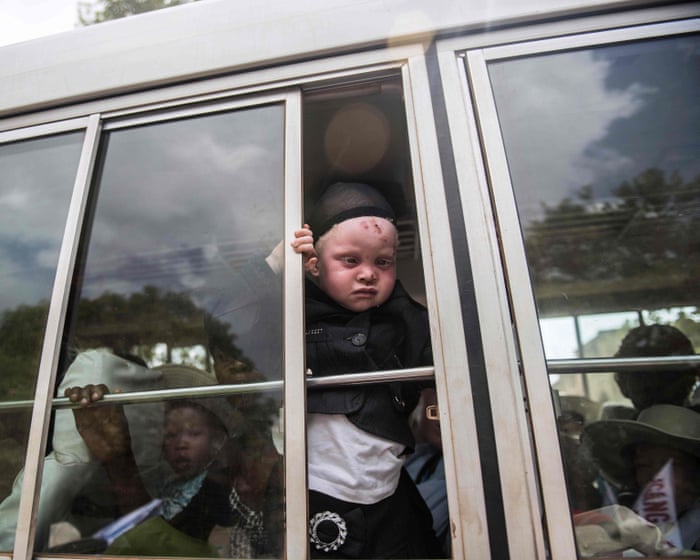 ‘I was devastated’: the Nigerian with albinism deported under Trump’s asylum crackdown