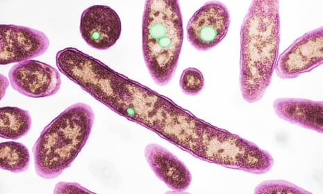 Transmission electron micrograph (TEM) of Legionella pneumophila, the bacteria known to cause legionnaires’ disease.