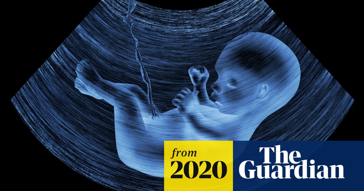 Ребенок в животе 12 недель фото Ребенок в животе 12 недель фото