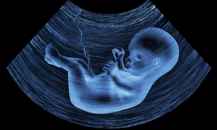ภาพอัลตราซาวนด์ของทารกในครรภ์มารดา