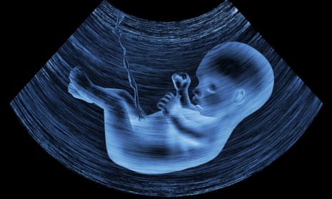 Ultrasound image of a baby in its mother’s womb.