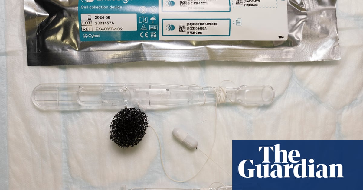 NHS pharmacies to pilot sponge on a string' test to spot cancer precursor