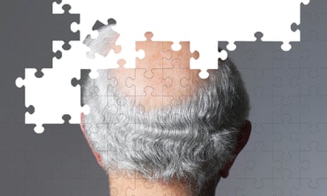 For many years Alzheimer’s was regarded purely as a result of age-related wear and tear; no one thought it had anything to do with the immune system.