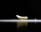 First human case of flesh-eating screwworm parasite confirmed in US