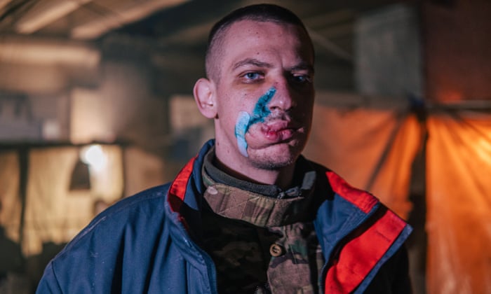 A handout picture made available by Regiment Azov press service shows an injured Ukrainian serviceman in a shelter at the Azovstal plant.