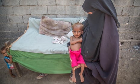 Yemeni mother on living with famine