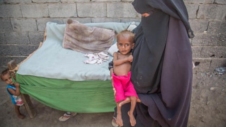 'I can't sleep, it's like torture': Yemeni mother on living with famine – video 