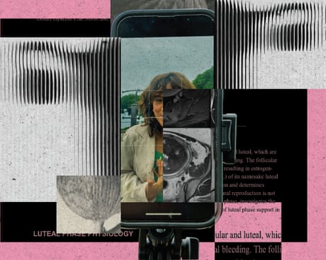 Collage of a woman on an iPhone with an image of a uterus
