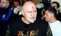 John Fury with blood on his face