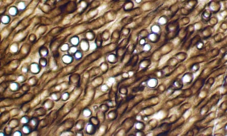 The microstructure of Prototaxites. Tubes are around a twentieth of a millimetre in diameter.