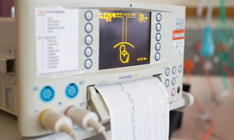 Electronic fetal monitoring in a hospital maternity ward, Kingston Upon Thames, Surrey, UK.