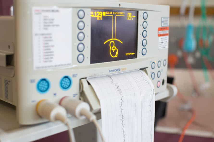 A machine monitors the unborn baby in a hospital maternity ward, Kingston Upon Thames, Surrey, England.