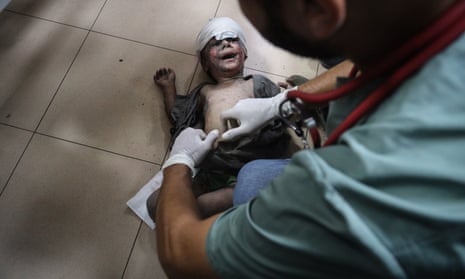 A doctor tends to a child at al-Aqsa hospital in Deir al-Balah after bomb hit a house near al-Bureij, central Gaza Strip.