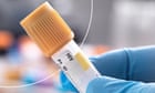'No new HIV cases by 2030': England hopes to become first country in the world to defeat virus