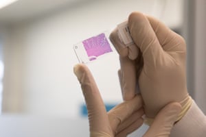 Andrew Affleck by removing tissue sections from the automatic staining device.