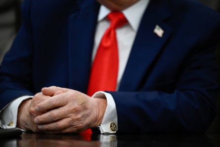 A bandage on Trump’s hand