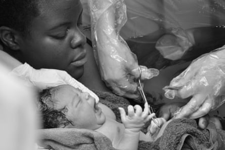 doctor cuts baby’s umbilical cord