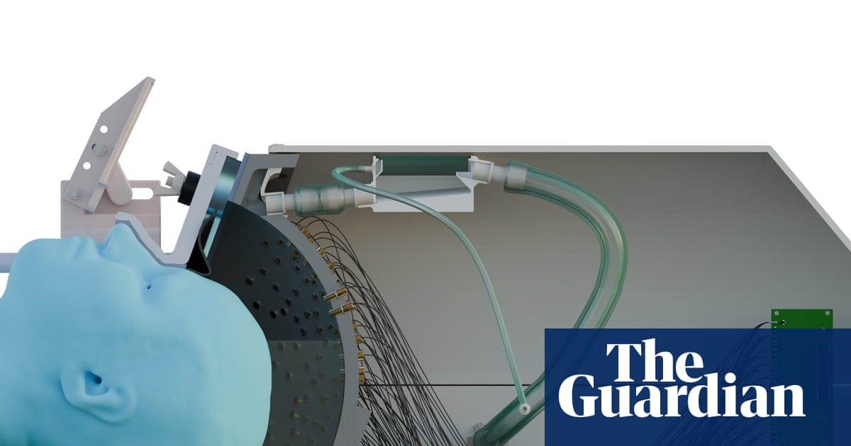 Ultrasound ‘helmet’ could treat Parkinson’s non-invasively, study shows | Medical research Ultrasound ‘helmet’ could treat Parkinson’s non-invasively, study shows | Medical research