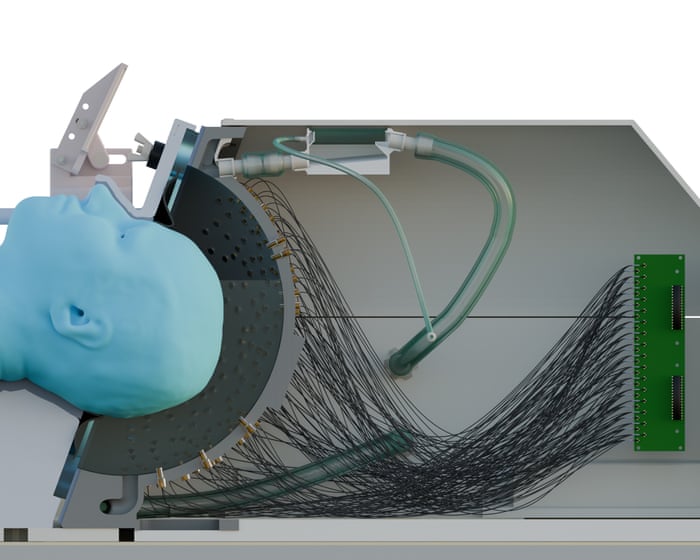 Ultrasound ‘helmet’ could treat Parkinson’s non-invasively, study shows
