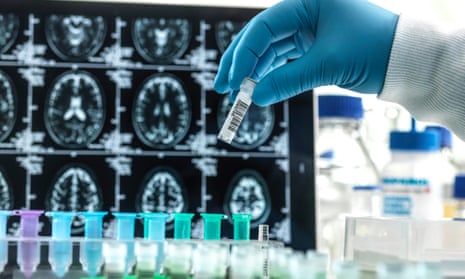 A scientist holding a vial in a laboratory with brain images in the background